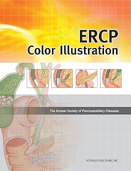 ERCP :color illustration /