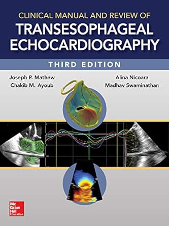 Clinical manual and review of transesophageal echocardiography /
