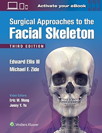 Surgical approaches to the facial skeleton /