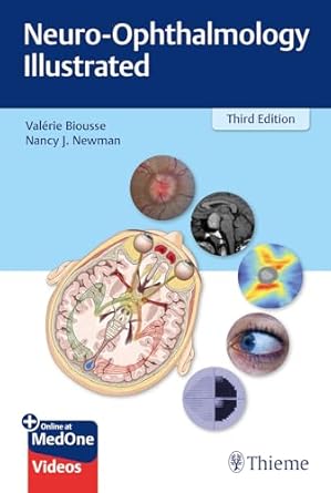Neuro-ophthalmology illustrated /