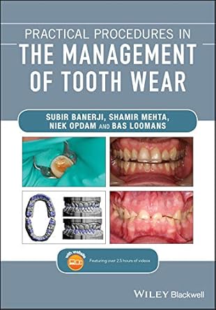 Practical procedures in the management of tooth wear /