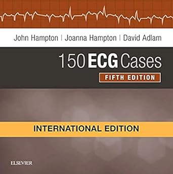 150 ECG cases /