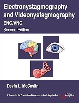 Electronystagmography/videonystagmography (ENG/VNG) /
