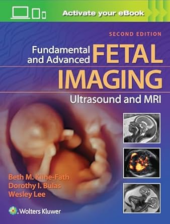 Fundamental and advanced fetal imaging :ultrasound and MRI /editors, Beth M. Kline-Fath, Dorothy I. Bulas, Wesley Lee