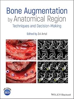 Bone augmentation by anatomical region :techniques and decision-making /