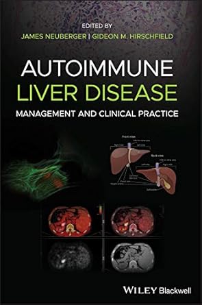 Autoimmune liver disease :management and clinical practice /