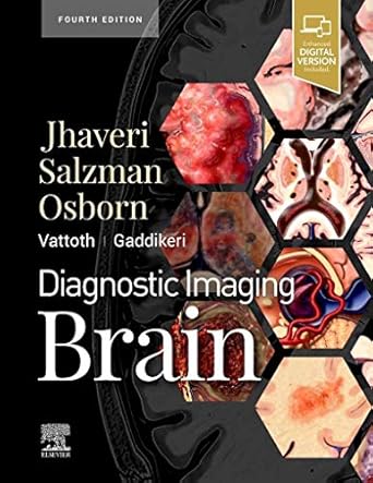 Diagnostic imaging. Brain /