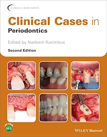 Clinical cases in periodontics /