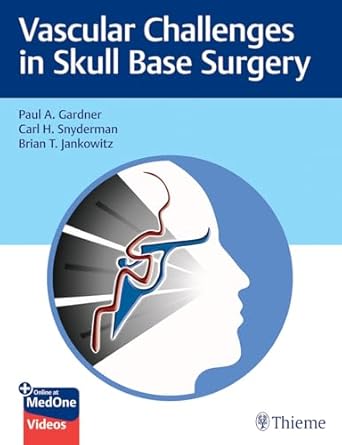 Vascular challenges in skull base surgery /