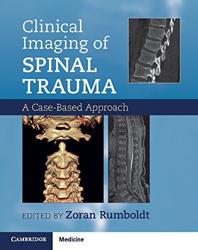 Clinical imaging of spinal trauma :a case-based approach /