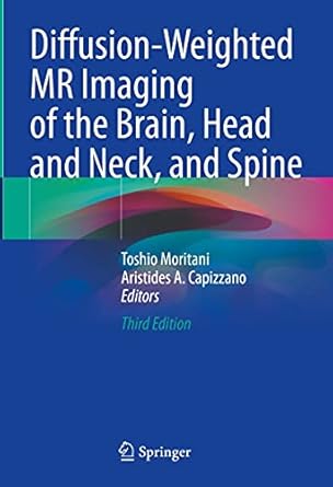 Diffusion-weighted MR imaging of the brain, head and neck, and spine /Toshio Moritani, Aristides A. Capizzano, editors.