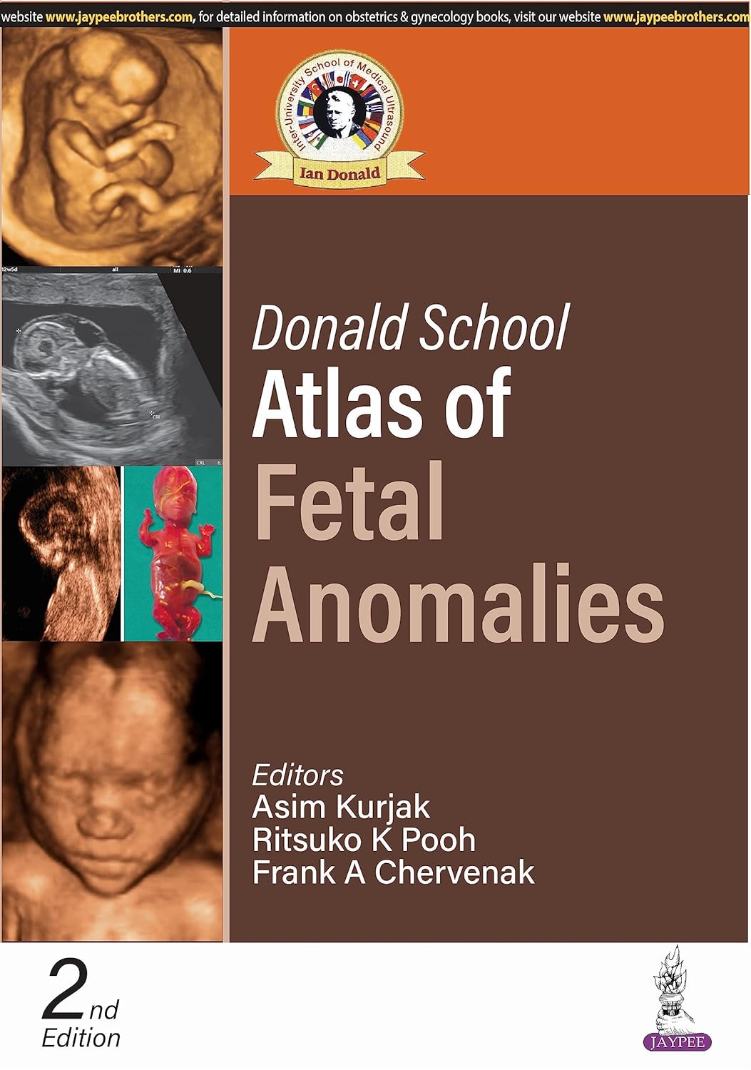 Donald School atlas of fetal anomalies /Asim Kurjak, Ritsuko K. Pooh, Frank A. Chervenak.