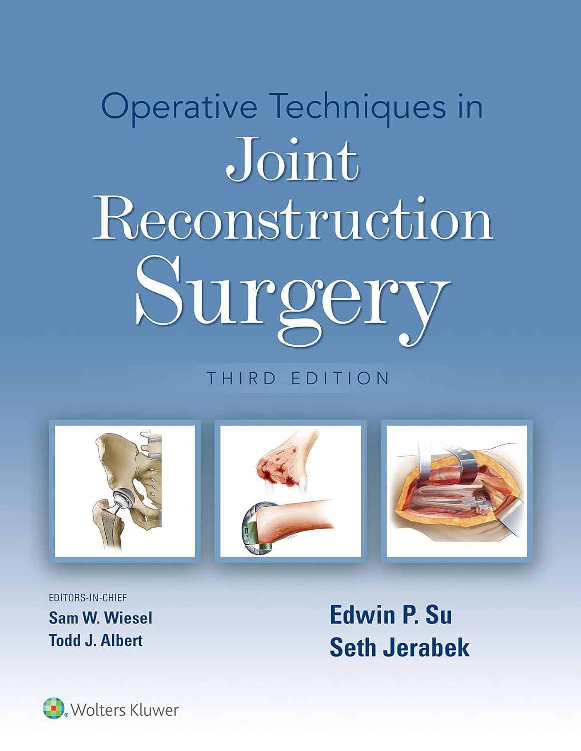 Operative techniques in joint reconstruction surgery /Edwin P. Su, Seth Jerabek, editors-in-chief, Sam W. Wiesel, Todd J. Albert.