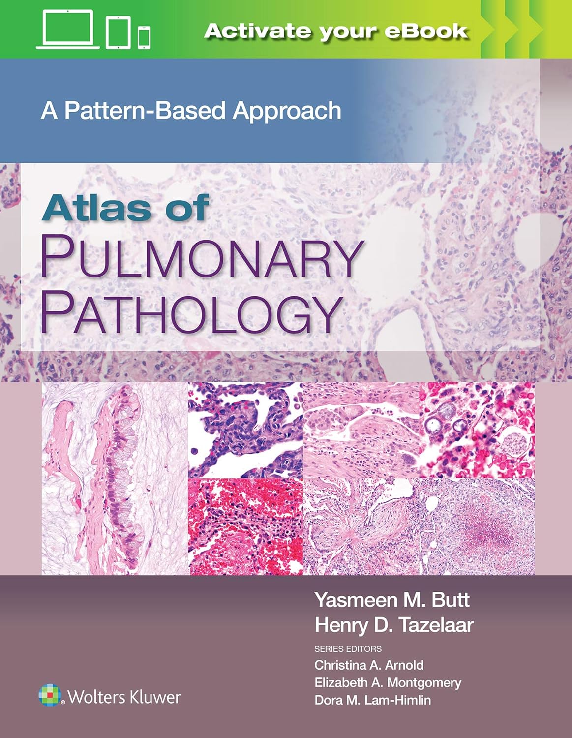Atlas of pulmonary pathology :a pattern based approach /Yasmeen M. Butt, Henry D. Tazelaar.