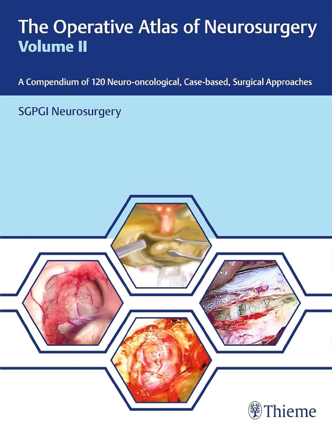 The operative atlas of neurosurgery :a compendium of 120 neuro-oncological, case-based, surgical approaches /SGPGI Neurosurgery.