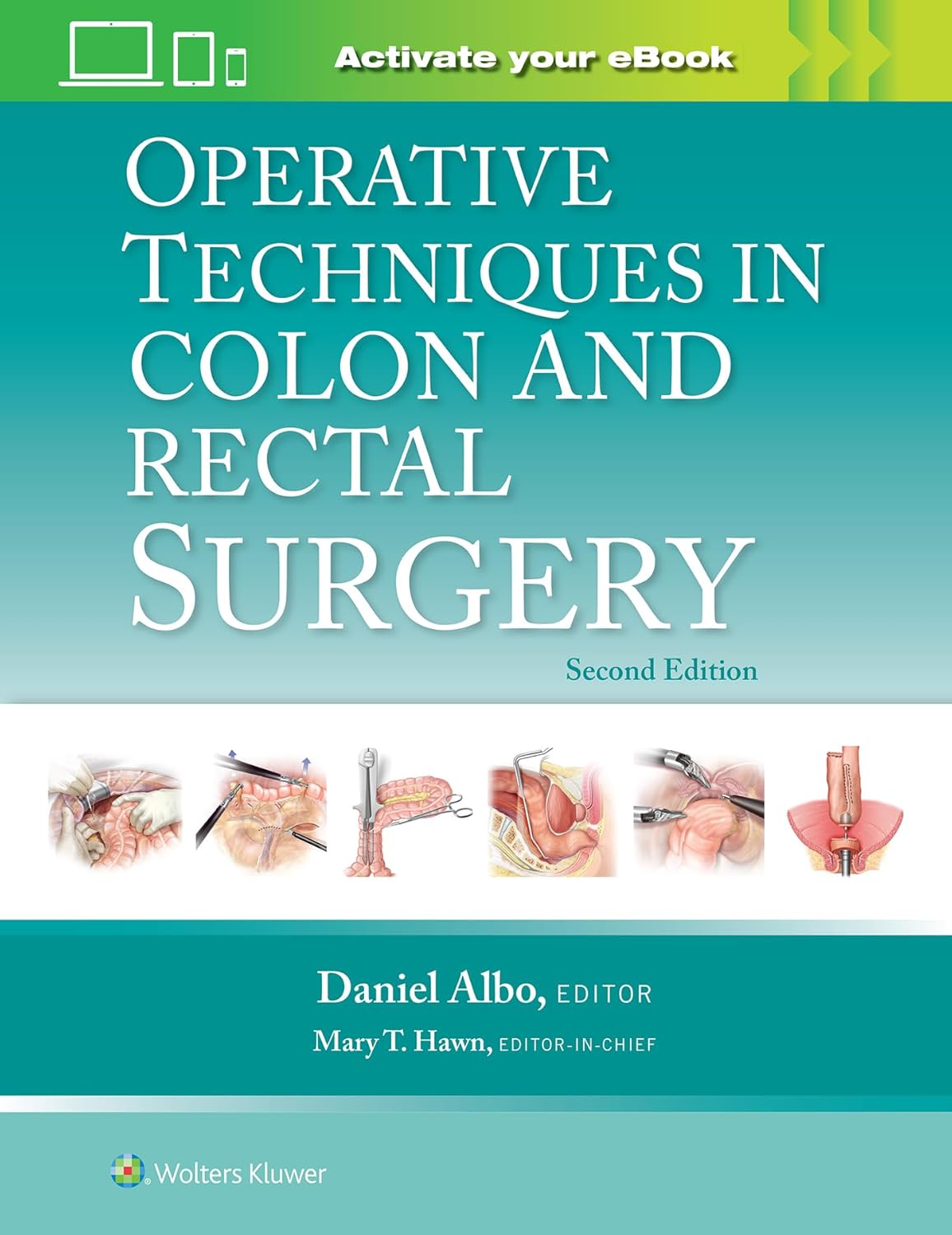 Operative techniques in colon and rectal surgery /Mary T. Hawn, editor-in-chief ; editor, Daniel Albo.