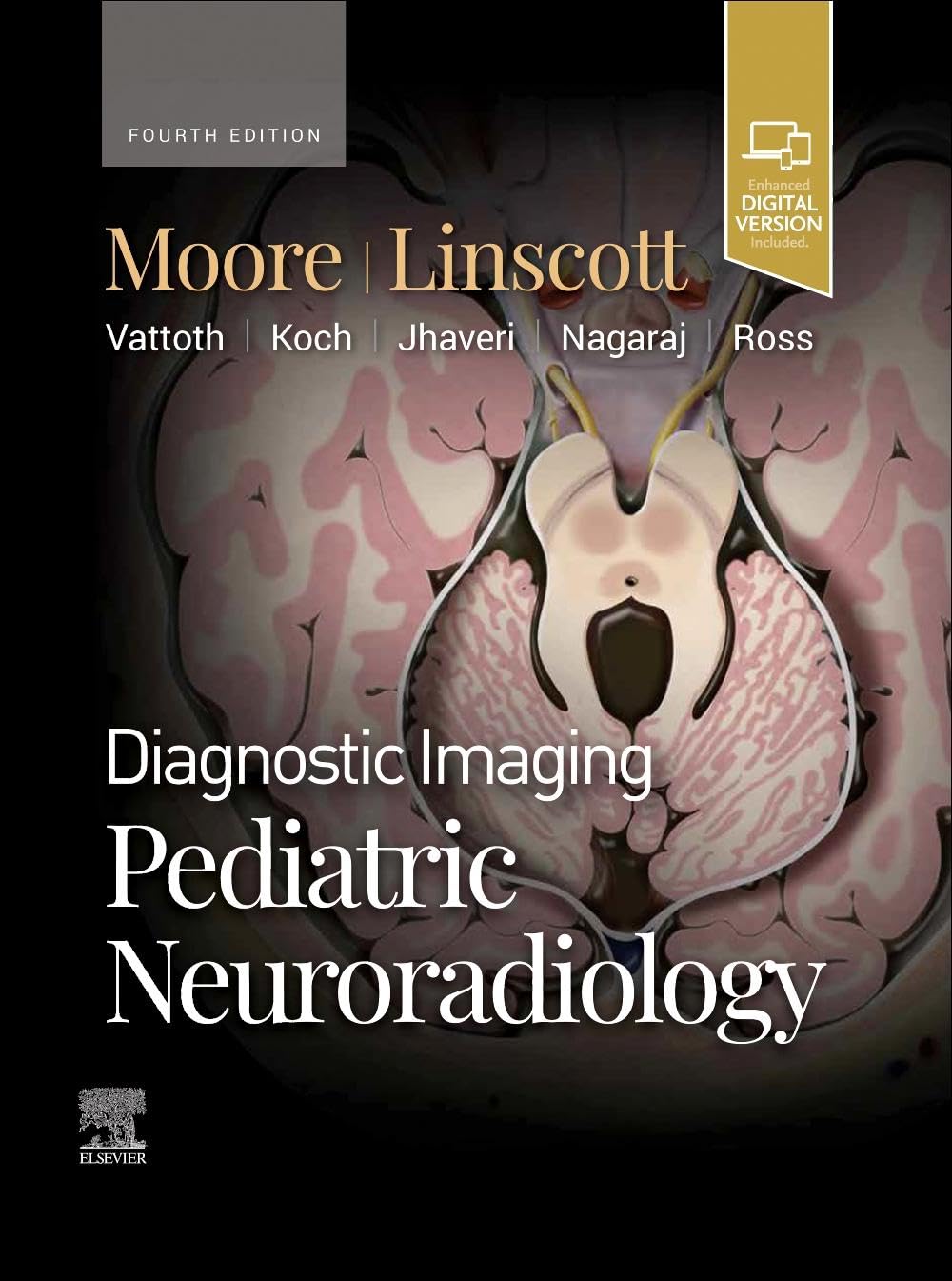 Diagnostic imaging. Pediatric neuroradiology /[edited by] Kevin R. Moore, Luke L. Linscott.